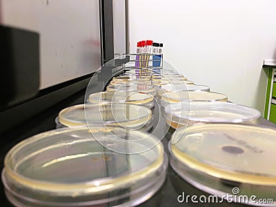 Microorganisms were grown in a plate of agar medium. Stock Photo