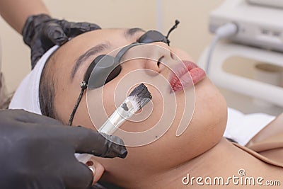 A young asian lady undergoes a laser carbon peel procedure at a skin or dermatologist clinic Stock Photo