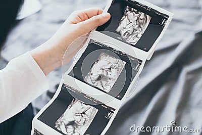 Young beautiful Asian pregnant woman with ultrasound film Stock Photo
