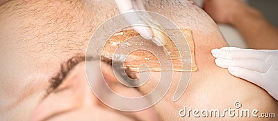 Young caucasian man receiving hair removal from his chest in a beauty salon, depilation men& x27;s torso. Stock Photo