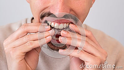 Young man adjusting and placing invisible silicone aligner for dental correction Stock Photo