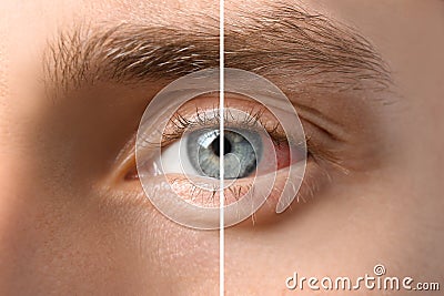 Young man with blue eyes, closeup Stock Photo