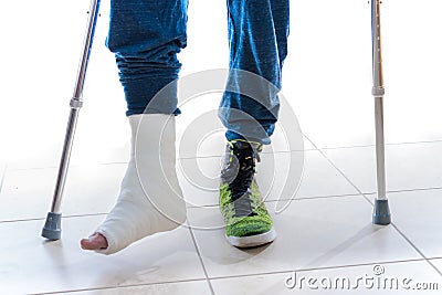 Young man with a broken ankle and a leg cast Stock Photo