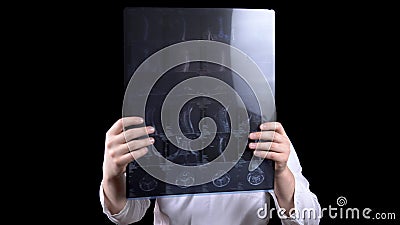 A young man doctor checks the results of an MRI scan of a spine. A man examines an MRI image on a black background. Stock Photo