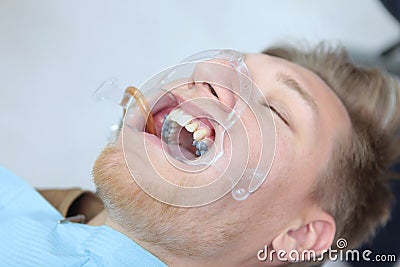 A young man installs braces in a dental clinic. Alignment of the dentition or bite.A dental expander.The concept of Stock Photo