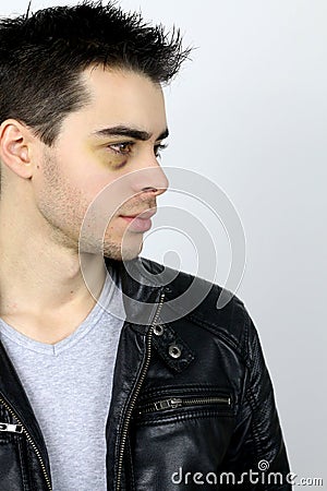 Young man with shiner Stock Photo