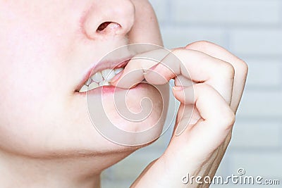 Young nervous caucasian woman bitting nails close up. Anxious, stressed, frustrated, embarrassed, neurotic, confused person Stock Photo