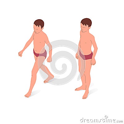 Young person, nude body anatomy. Isometric vector illustration of a standing person. Vector Illustration