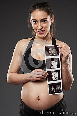 Pregnant lady showing morphology scan Stock Photo