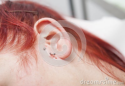 Young red-haired girl with piercing jewel just after to be pierced on ear skin Stock Photo