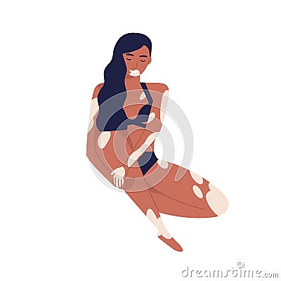 Young self acceptance woman with vitiligo relaxing in bikini. Body positive, brunette girl with skin depigmentation or Vector Illustration