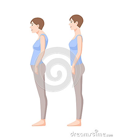 Young smiling woman standing in good and bad postures isolated on white background. Neutral spine, correct and incorrect Vector Illustration