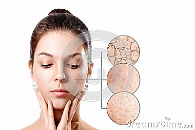 Young woman with acne, dry skin, black dots skin in zoom circle . Skin care concept. Young girl, beauty portrait. Close-up Stock Photo