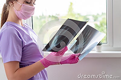 Young woman doctor looking at xray radiography images at clinic. Physician, surgeon reviewing scan of patient bones Stock Photo