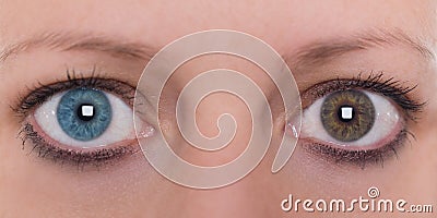 Young woman with heterochromia iridis, blue and brown eye colour Stock Photo