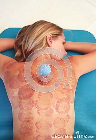 Young woman lies on a carpet with traces of vacuum massage Stock Photo