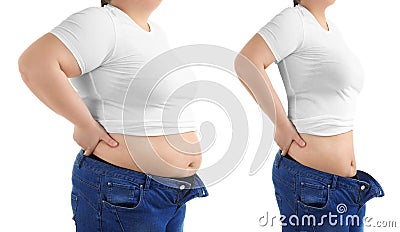 Young woman before and after liposuction operation Stock Photo