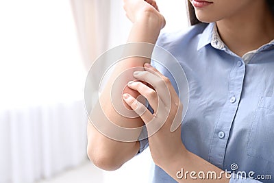 Young woman scratching hand indoors, space for text. Allergies symptoms Stock Photo