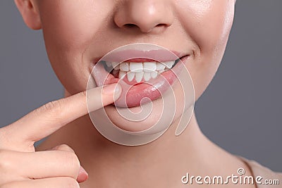 Young woman showing inflamed gums on grey background, closeup Stock Photo