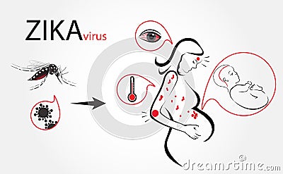 Zika virus fever Vector Illustration