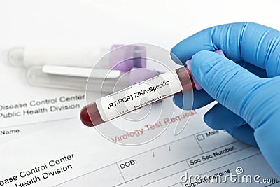 Zika Virus Lab Test Stock Photo