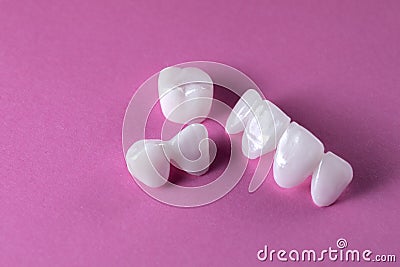 Zircon dentures on a pink background - Ceramic veneers - lumineers Stock Photo