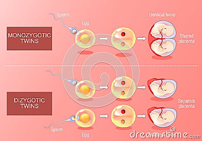 Zygote developments in monozygotic and dizygotic twins Vector Illustration