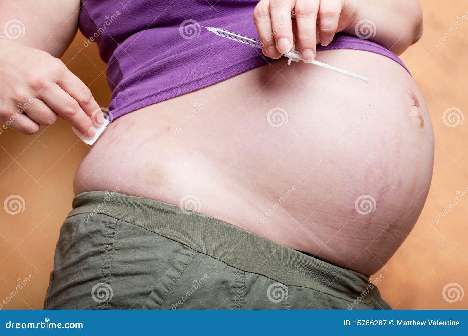 вздутый животик у девушки. отекают живот у беременной. беременность отекает живот. беременность отекает живот. растяжки при беременности.