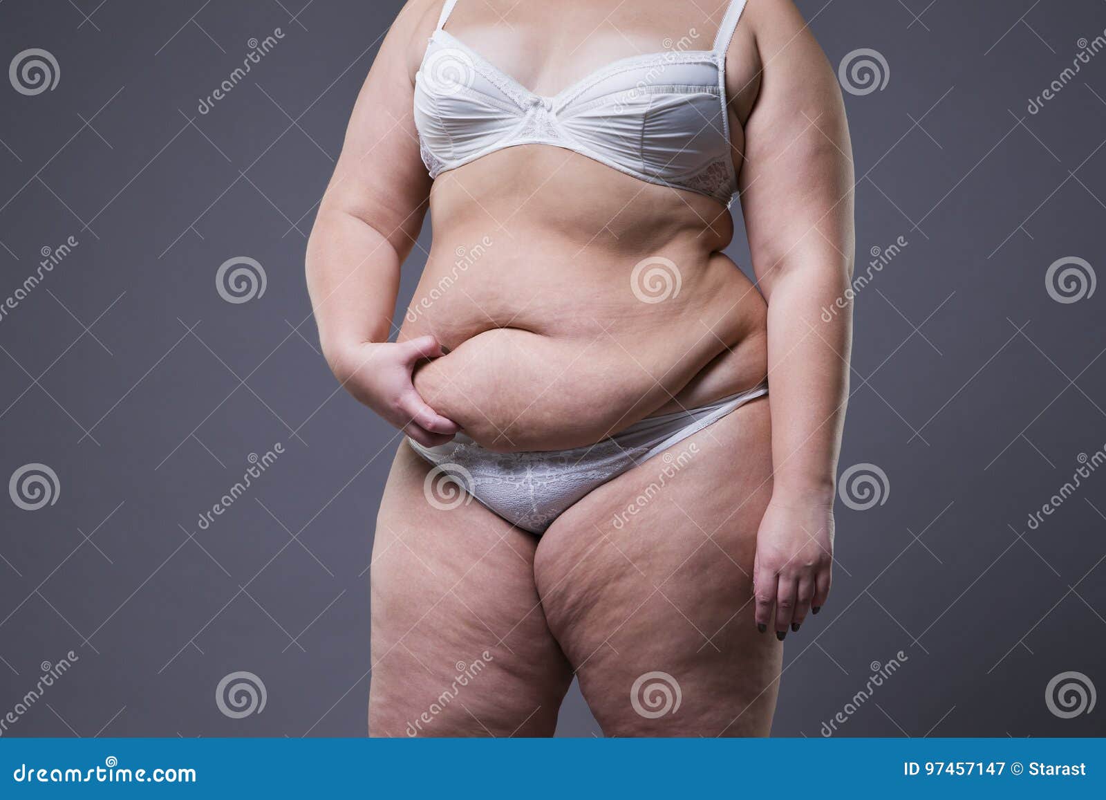 Огромный дряблый живот. Висячий живот девушка. Висячий живот девушка. Девушка с животиком толстеньким. Висячий живот девушка.