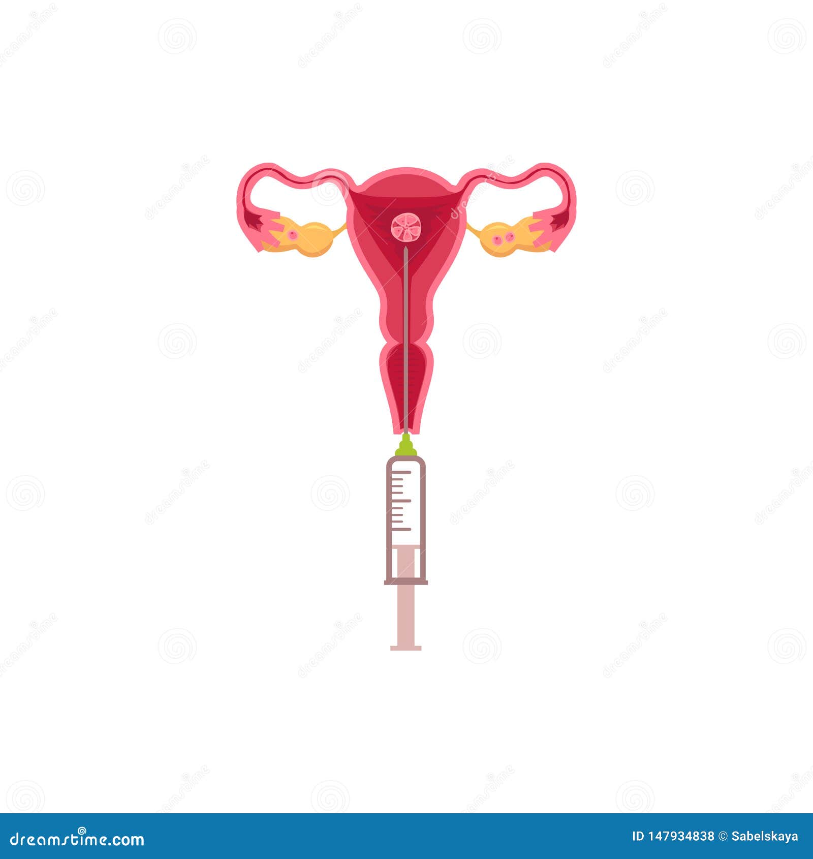 Инсеминация Цена