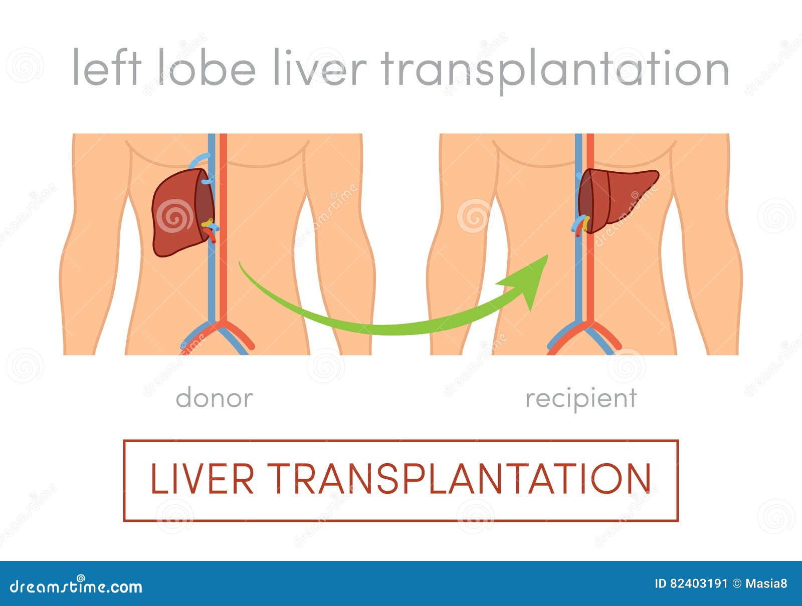 Трансплантация Печени Цена