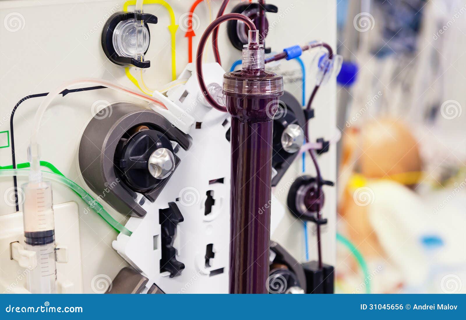 Чистка Крови Плазмаферез Цена