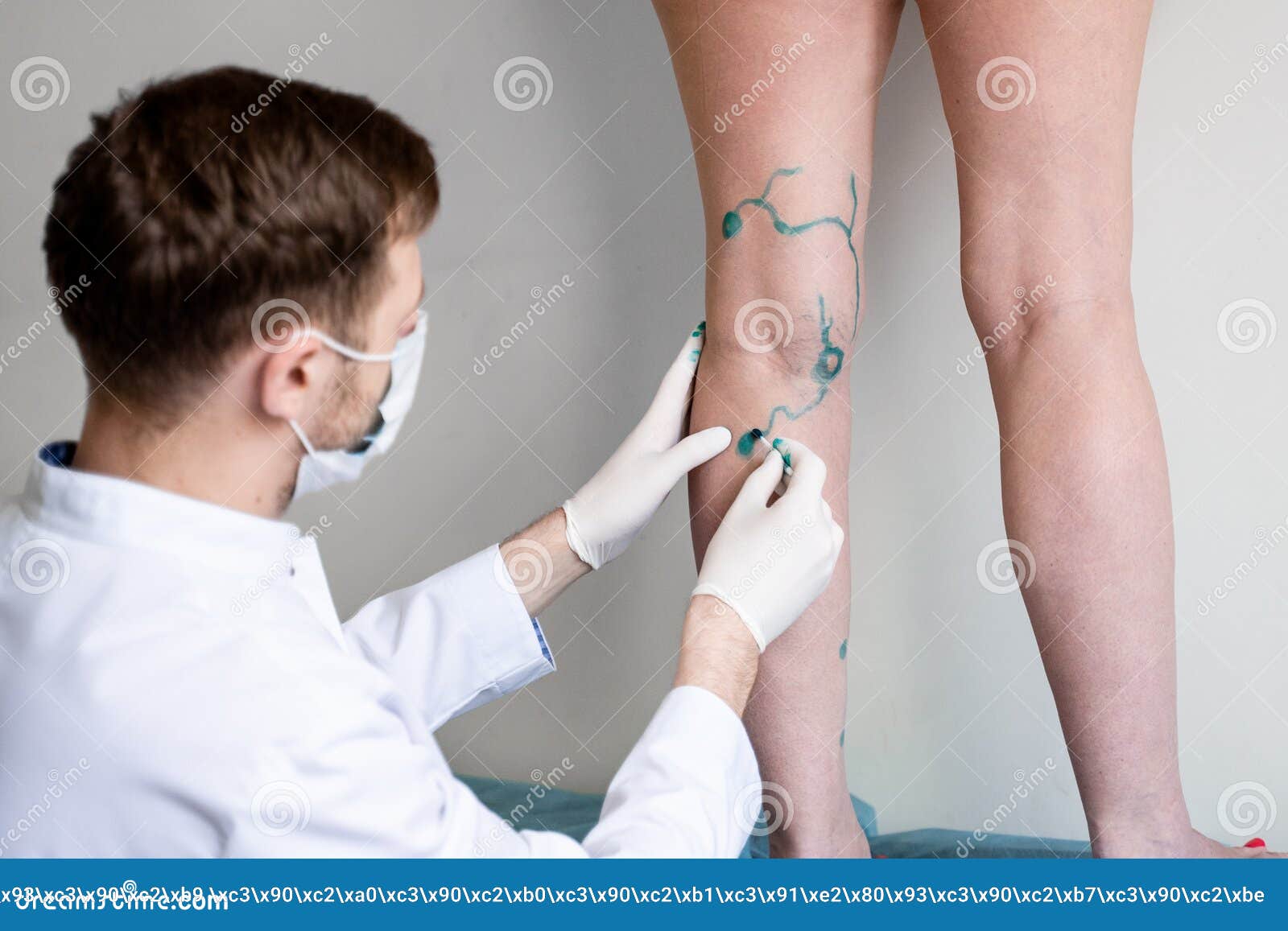 Удаление Вен Лазером Стоимость