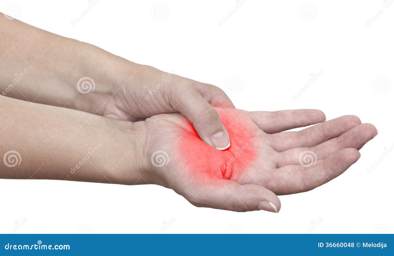 жгучая боль пальцев