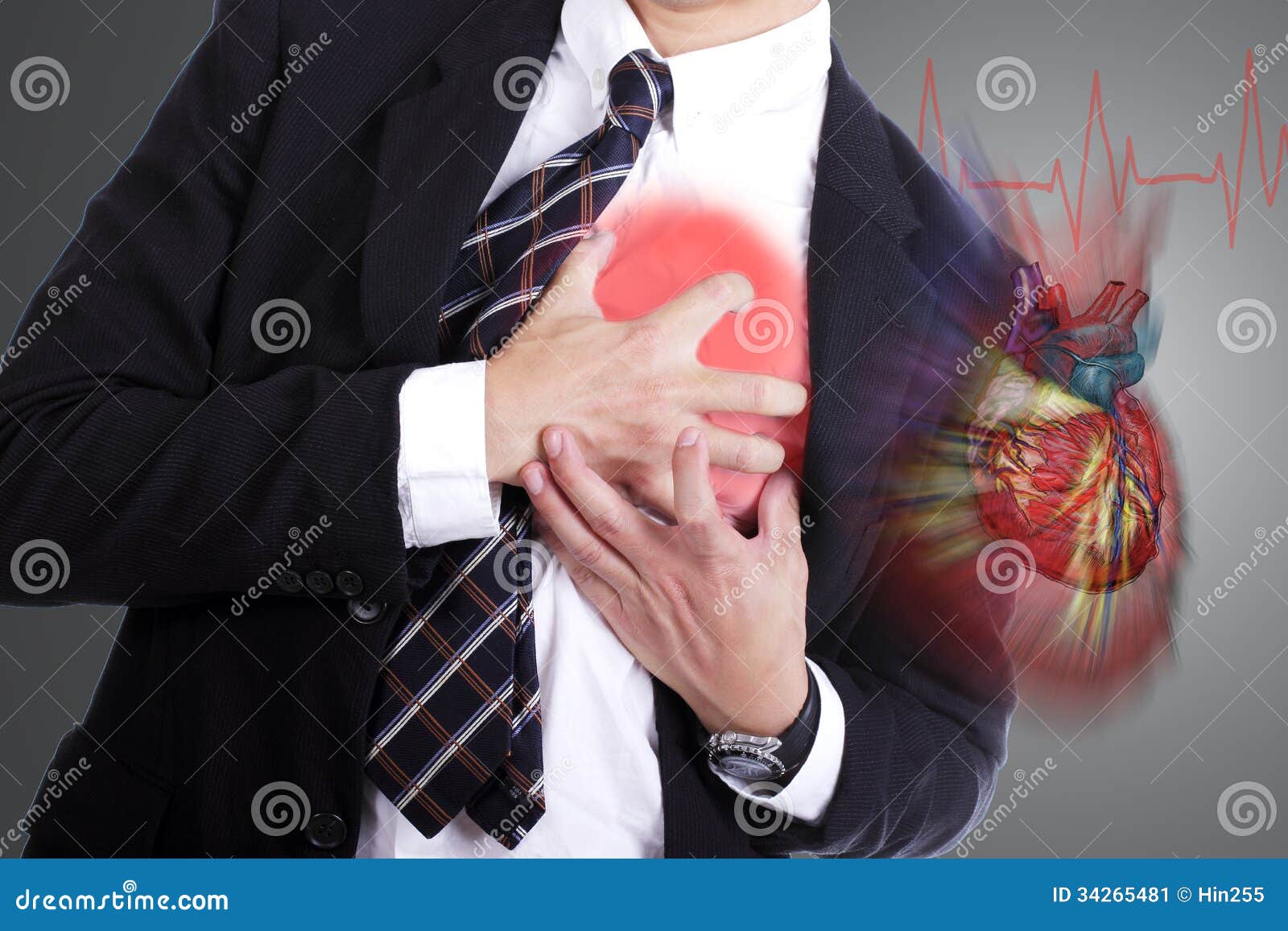 Ms Heart Attack