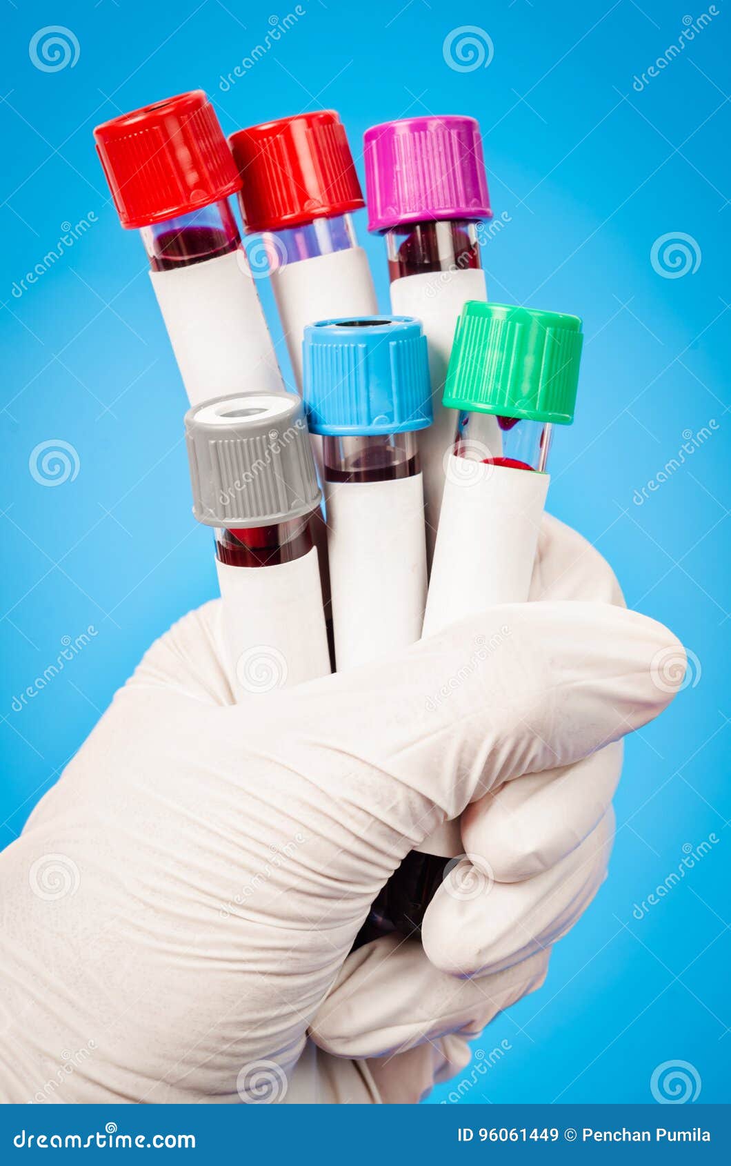 Исследование мочи в лаборатории. Кровь в пробирке. Лабораторные исследования пробирки. Лабораторные исследования пробирки. Кровь в пробирке.