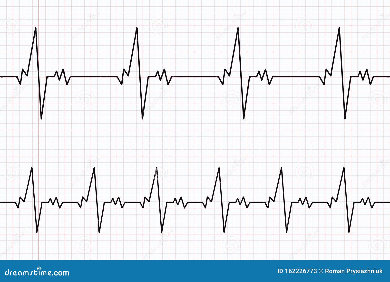 καρδιογράφημα ΗΚΓ Φόντο χαρτιού ηλεκτροκαρδιογραφήματος Διάνυσμα  Διανυσματική απεικόνιση - εικονογραφία από : 162226773