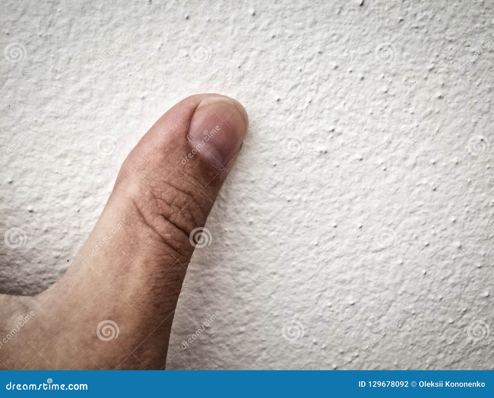 Большой Палец На Руке Фото