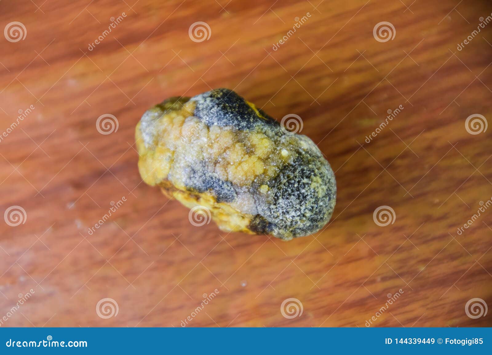Камни желчном рассосались. Желчный пузырь камни до 7 мм. Камни в жёлчном пузыре смакропрепарат.