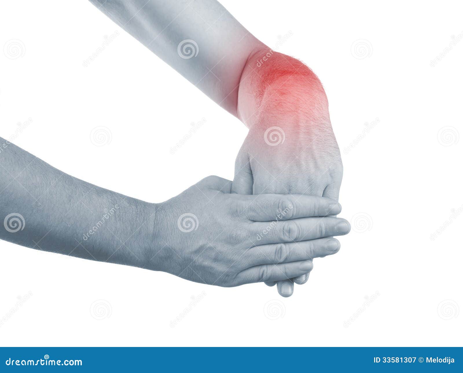 Ноющая боль в левой кисти. Болит рука в лучезапястном суставе. Боль в руке. Болит наружная сторона запястья. Болит запястье левой руки сверху.
