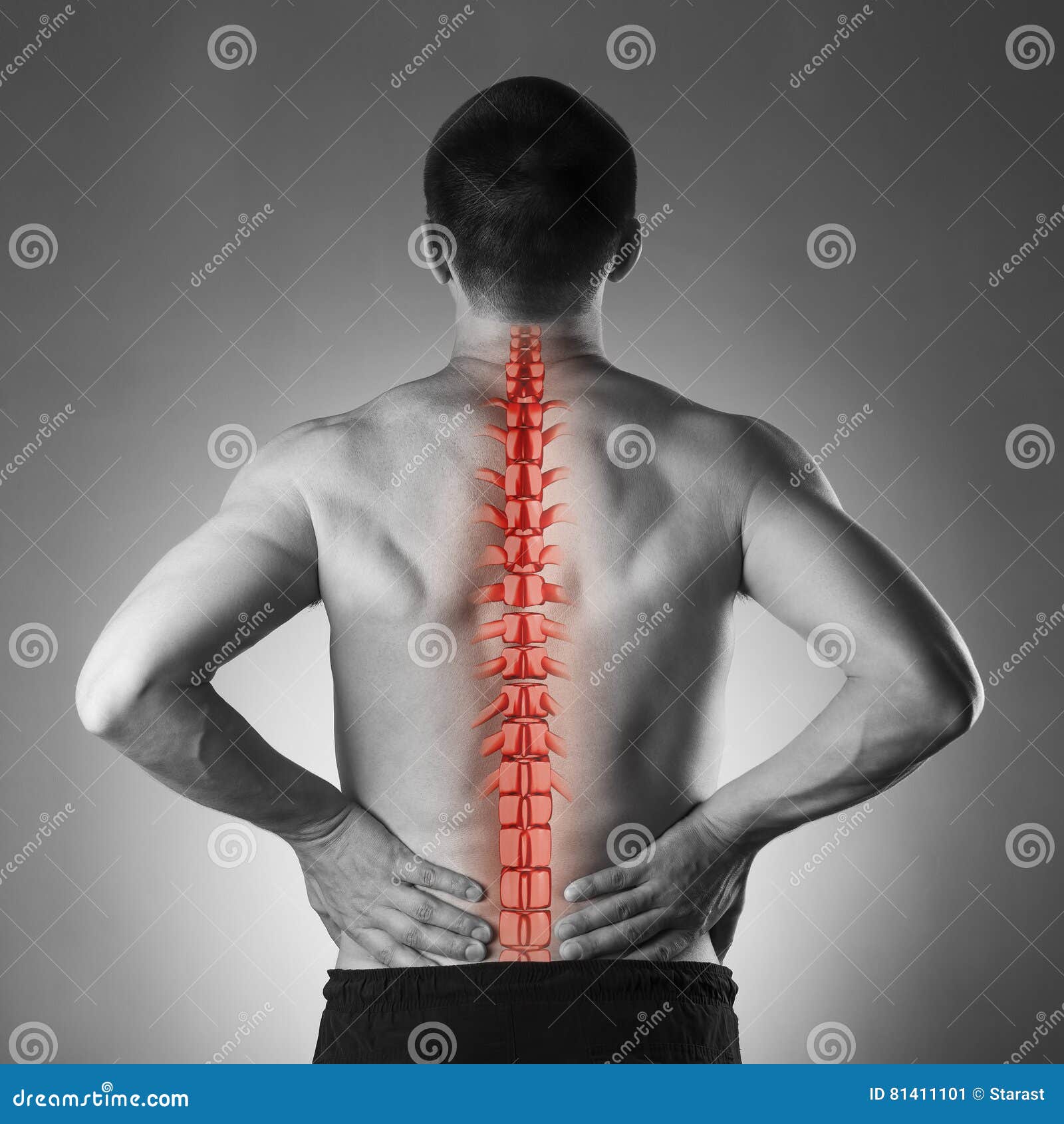 человеческий позвоночник. как должен выглядеть позвоночник. как должен выглядеть позвоночник. как должен выглядеть позвоночник.