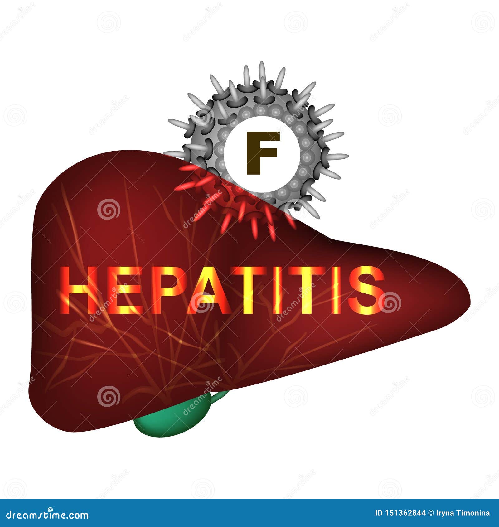 Гепатит f