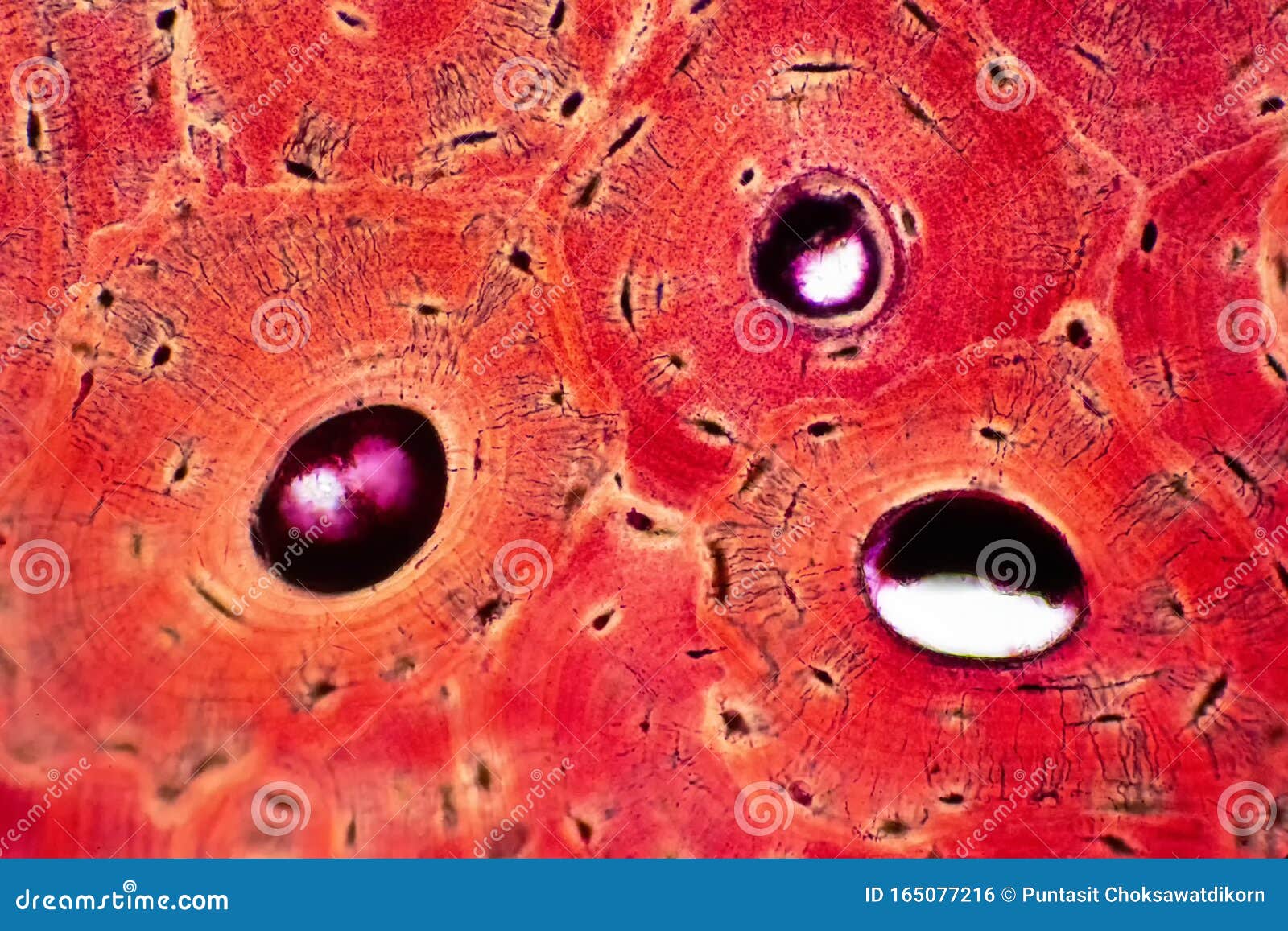 Плотное образование внутри клетки. Соединительная ткань под микроскопом. Ткани человека под микроскопом. Человеческие ткани под микроскопом. Соединительная ткань фото под микроскопом.