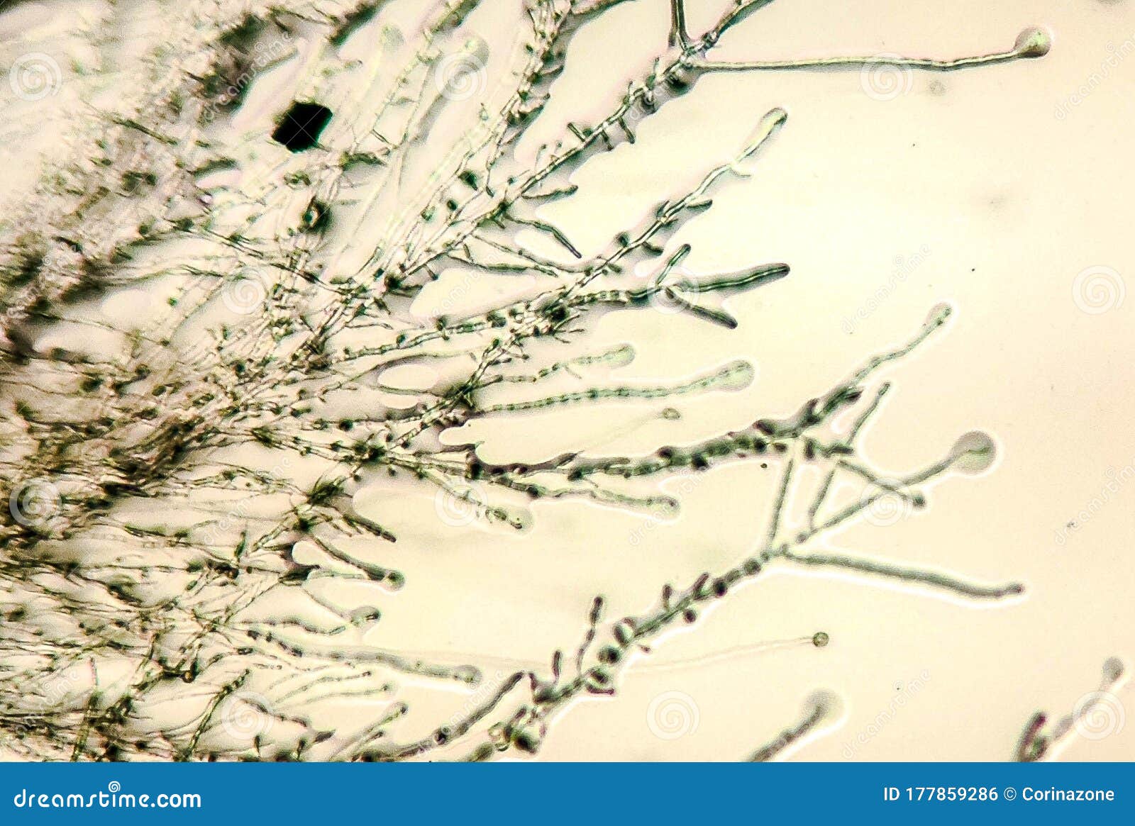 Грибок Dermatophyte под микроскопом Стоковое Фото - изображениенасчитывающей микроскоп, колония: 177859286