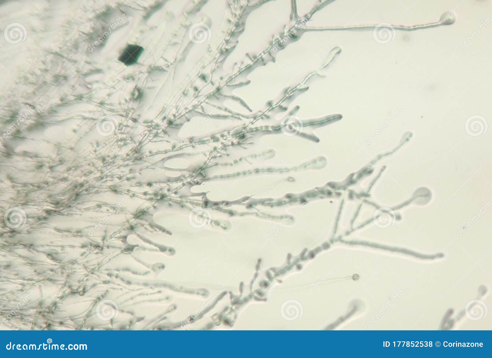 Грибок Dermatphyte под микроскопом Стоковое Фото - изображениенасчитывающей наука, здоровье: 177852538