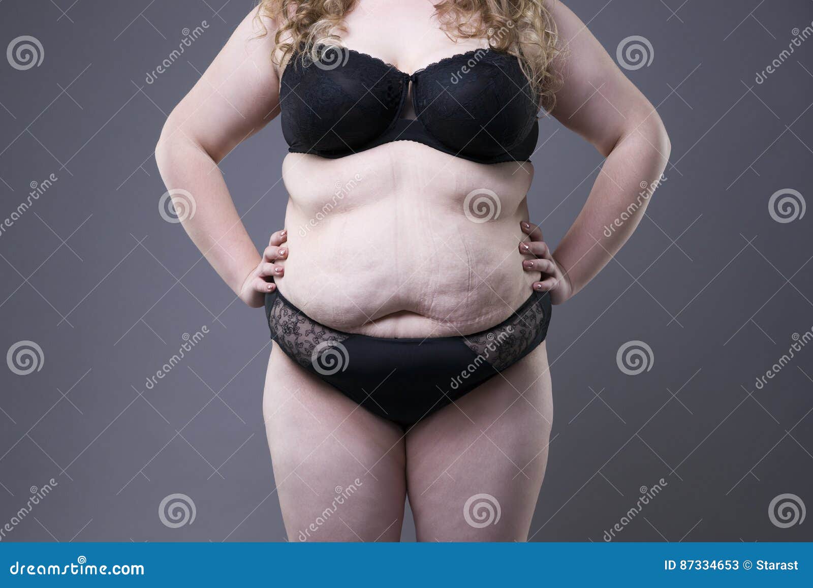 Тело толстой женщины