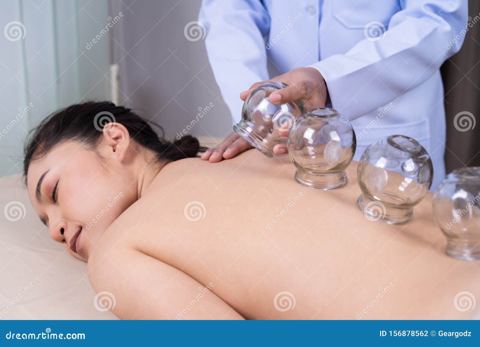 При какой температуре можно ставить банки. Схема постановки банок на спину при кашле. Банки на спину схема постановки. Места постановки медицинских банок. Медицинский банки на спину.