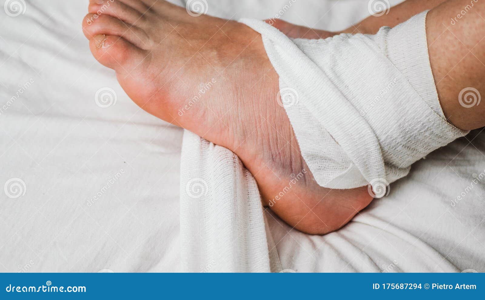 Лодыжка На Ноге Фото Лодыжка На Ноге Фото