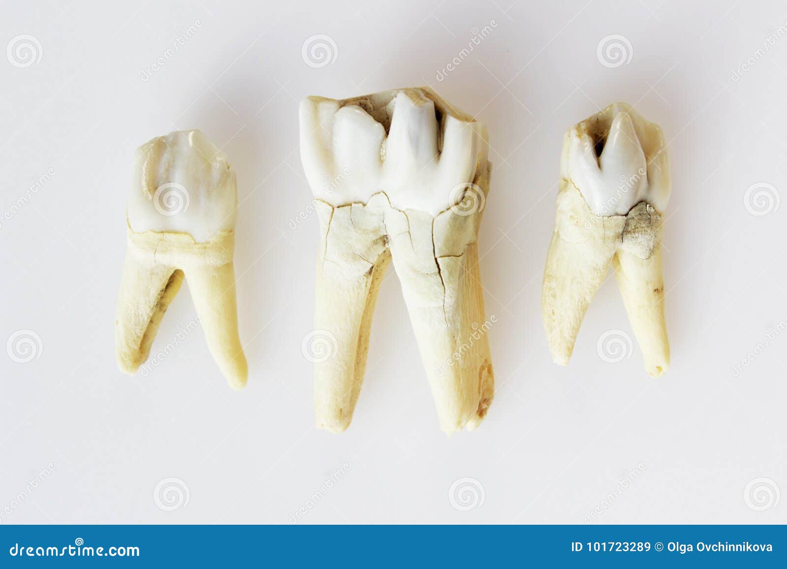 3 Зуба Фото