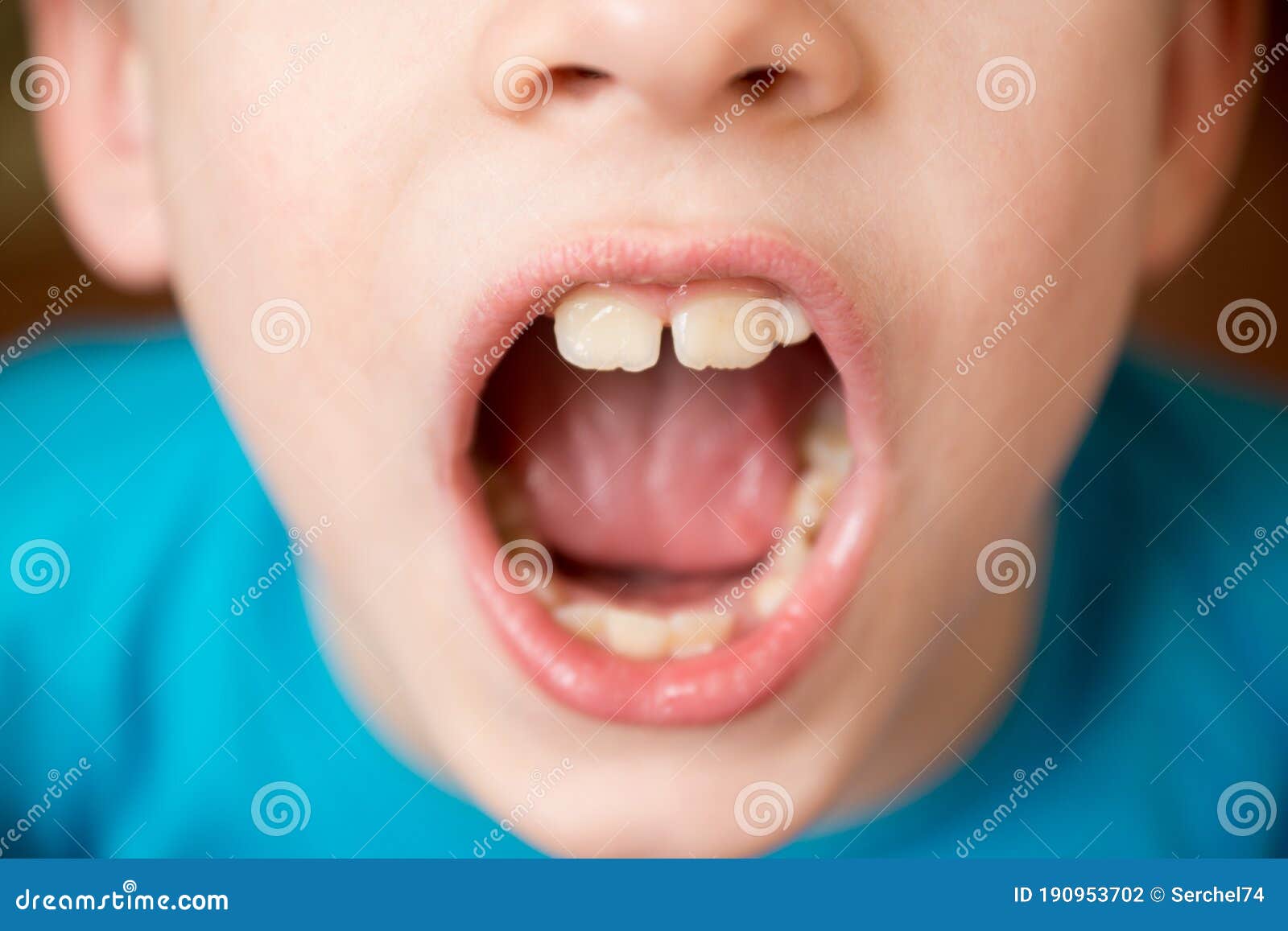 Мальчик открывающий рот. Мальчики с открытыми ртами. Мальчик открыл рот. Маленький мальчик с открытым ртом.